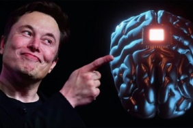 elon-musk-neuralink-projesi-kapsaminda-gelistirdigi-cipi-insan-beynine-takmaya-hazirlaniyor-9Dz8uFRI.jpg